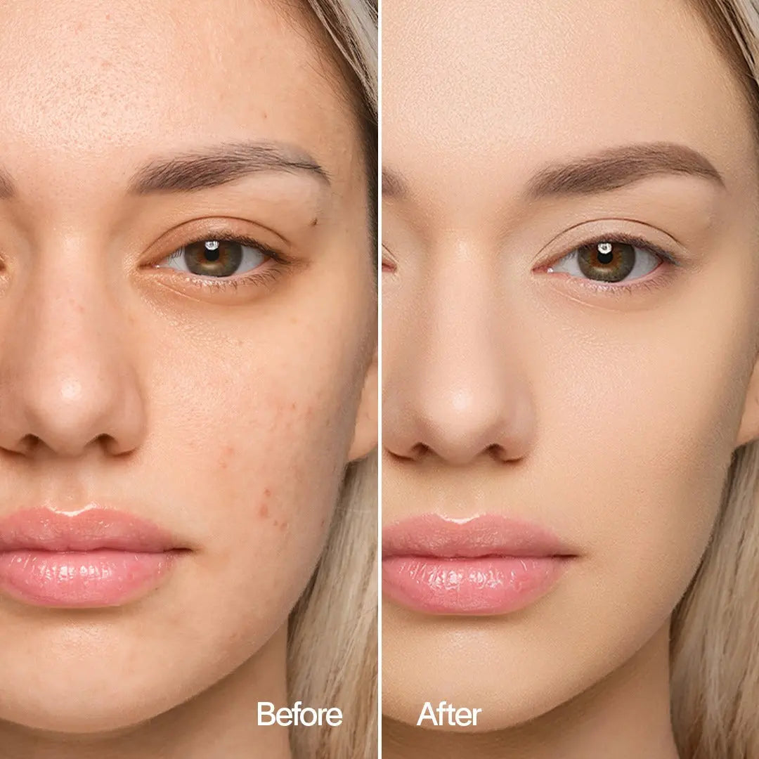 SOLAR DEFENCE COMPACT FOUNDATION Chogan